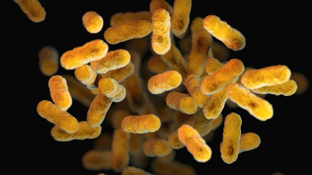 Top 5 Probiotic Foods for Your Body